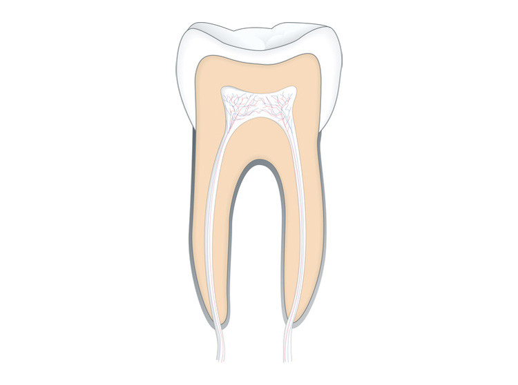 Endodontie &ndash; Wurzelkanalbehandlung