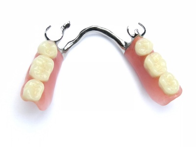 Teilprothese / Modellgussprothese